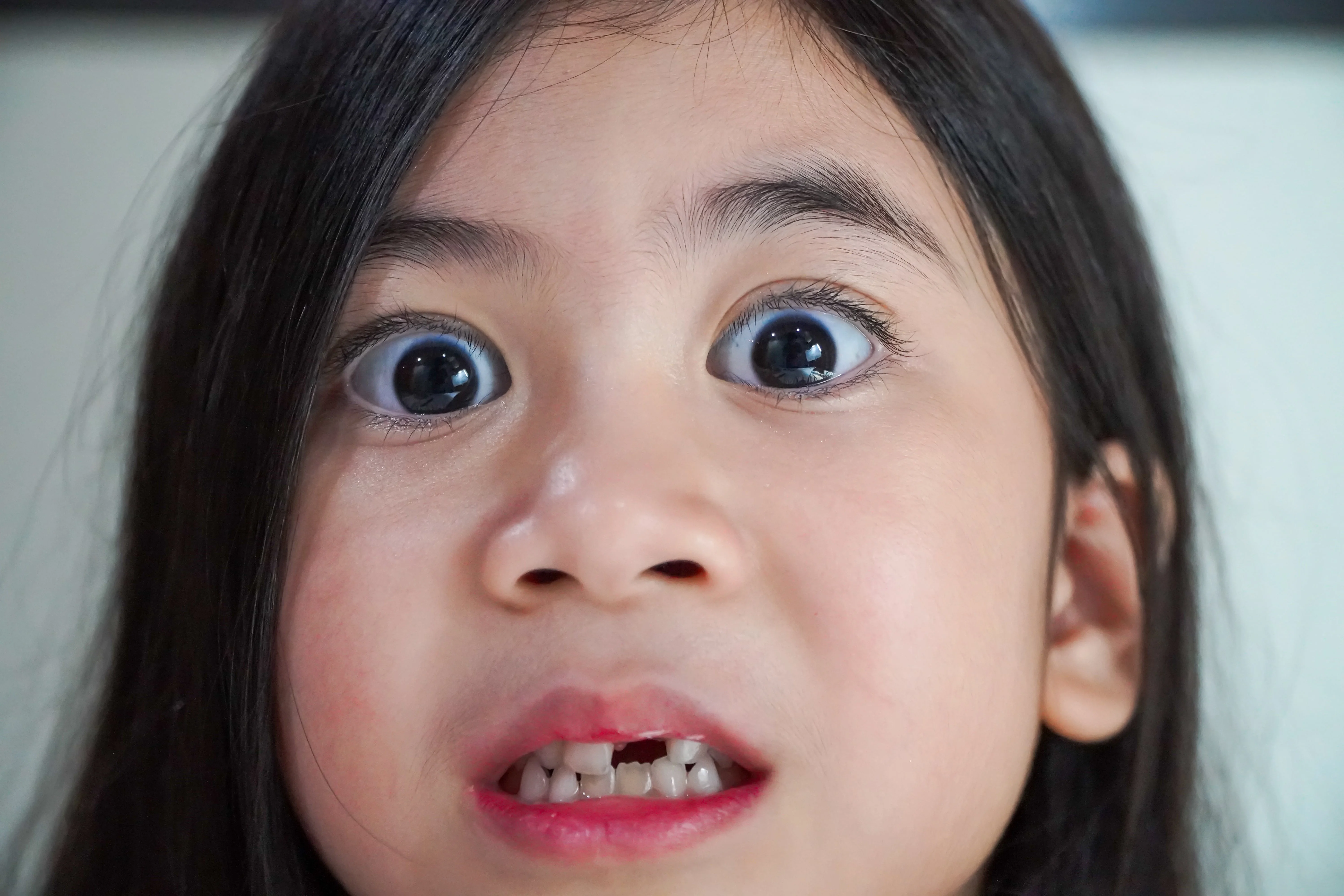 Cute bigeyed asian babe makes funny faces with her baby teeth falling out